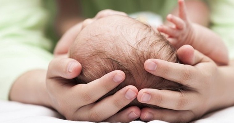 Imagem de bebê com microcefalia